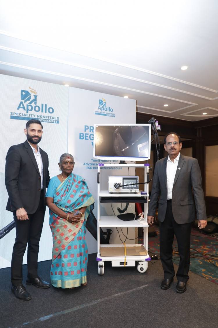 Apollo Speciality Hospitals, Teynampet Successfully Removes 15-cm Colon Tumor in 80-Year-Old Using Advanced Zoom Scope Technology 